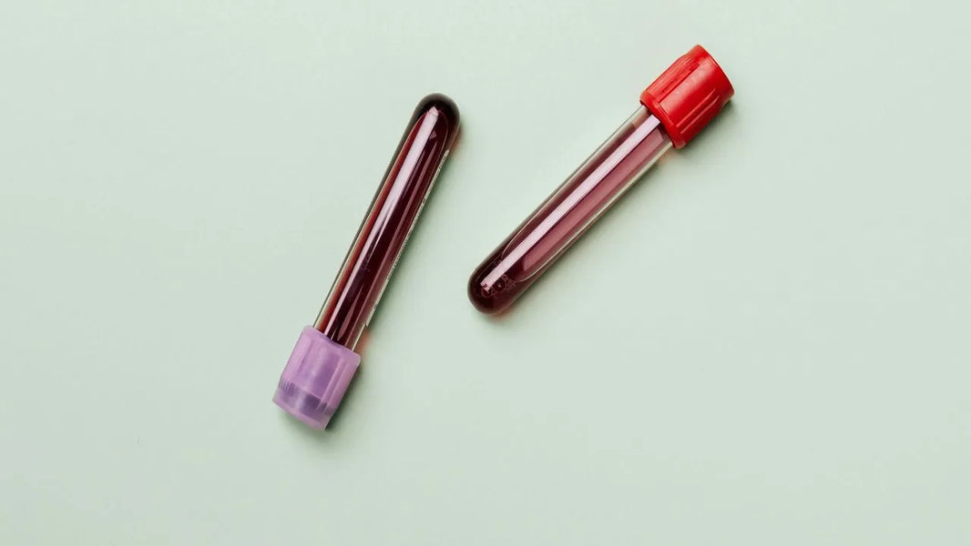 Get Tested, Stay Informed: Why STI Screening Matters More Than Ever